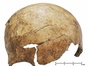 Mass grave reveals prehistoric warfare in ancient European farming community
